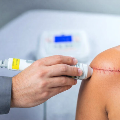 Tratamento de ultrassom pós-operatório
